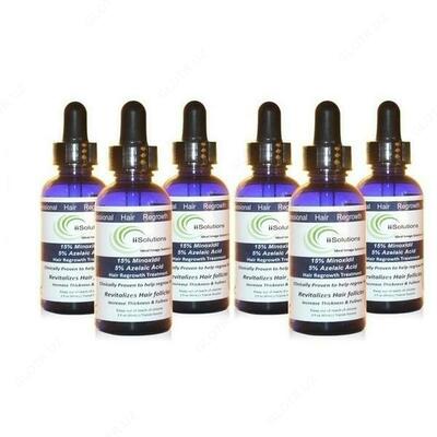 Soch osishi uchun loson Minoxidil 15% -